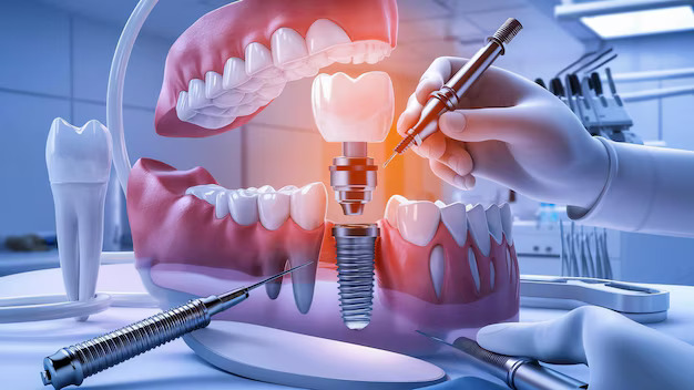 magic-of-dental-implant.php