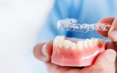Invisalign Clear Aligner Clinic in Ahmedabad India – Teeth Care